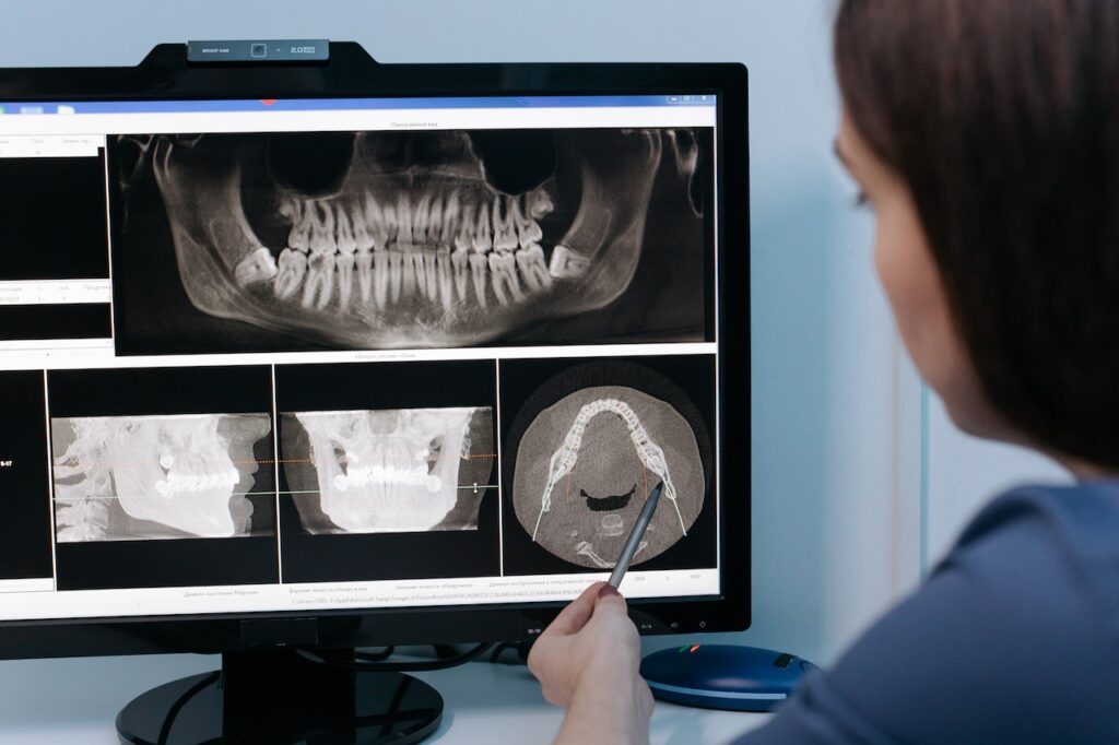 Sistema odontológico: a saída para mais tempo livre